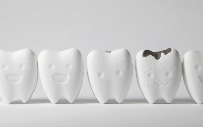 Our Very Own Dr. Yamashiro Discusses Tooth Decay