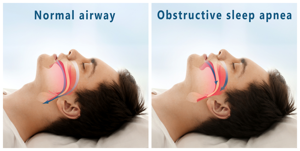 airway explained